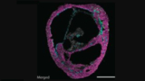 Aus Stammzellen selbstorganisiert aufgebautes Cardioid, das alle drei "cardiac lineages" enthält.
