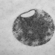Mycoplasma-Zelle mit Minimalmembran in elektronenmikroskopischer Aufnahme