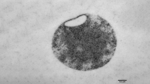 Mycoplasma-Zelle mit Minimalmembran in elektronenmikroskopischer Aufnahme