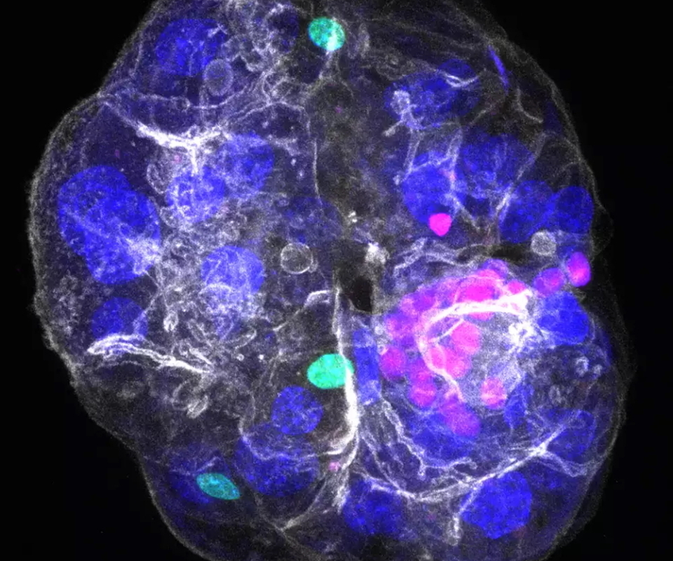 Assembloid_MPI-CBG Voll funktionsfähiges periportales Assembloid mit den drei Leberzelltypen Cholangiozyten (rosa), Fibroblasten (grün) und Hepatozyten (blaue Zellkerne).