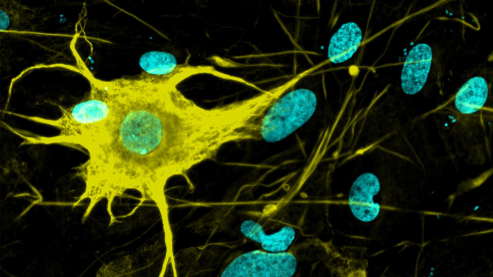 Neuron_ETH-Zürich_cut Nur einer von hunderten verschiedenen Nervenzelltypen, die im Labor aus Stammzellen erzeugt wurden.