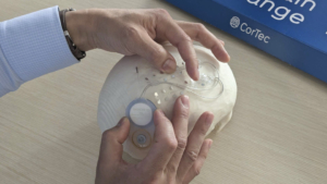 Zwei Männerhände zeigen an einem Schädel den Sitz den Implantats.