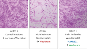Funktioneller Bioassay: Wundexsudat (Wundflüssigkeit) aus chronischen Wunden schädigt und tötet menschliche Zellen. Der Wirkstoff AKR101 stellt normales Zellwachstum wieder her.