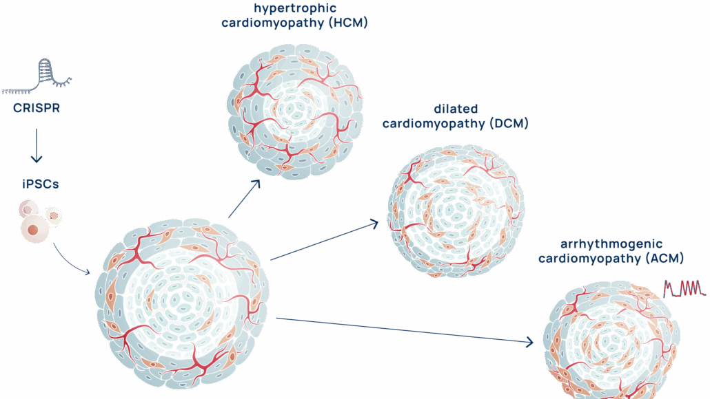 Die Cardioids von Heartbeat.Bio ahmen die strukturellen und molekularen Defekte nach – wie etwa Kammererweiterung, verringerte Größe und fibrofettigen Ersatz von Herzmuskelzellen –, die bei verschiedenen Formen erblicher Kardiomyopathien vorkommen.