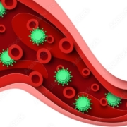 Sepsis entsteht, wenn eine lokale Infektion systemisch wird.