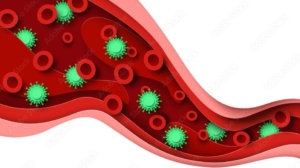 Sepsis entsteht, wenn eine lokale Infektion systemisch wird.