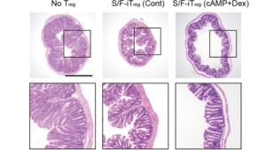 Fig5 Histologische Aufnahmen von Dickdarmgewebe zum Studienendpunkt (n = 4–6 Mäuse pro Gruppe)