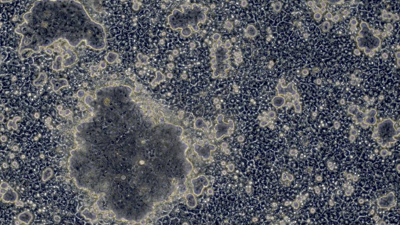 Wenn das CDX2-Netzwerk aktiv ist, bilden die Stammzell-Leberzellen ungewöhnlich große Gallenkanälchen mit Darmenzymen.