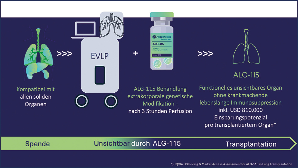 ALG-115 Immungentherapie - optimiert für den operativen Transplantationsprozess