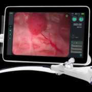 Zystoscopes-img-960x540-optimed