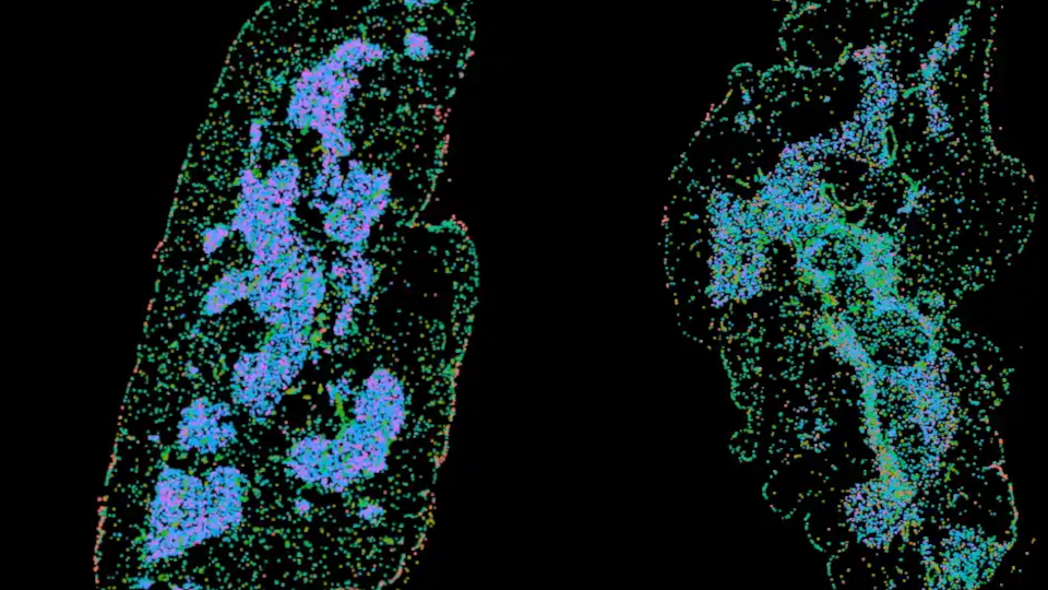 thymus vergleich TECregen web Thymusgewebe im Vergleich: links gesunde Kompartimentierung (Medulla, Cortex), rechts "involvierter", weniger funktionsfähiger Thymus