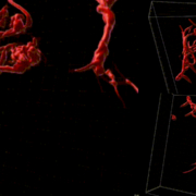 Blutgerinnsel in 3D. EMPA-Forscher wollen mit Machine Learning ein besseres Verständnis von Mikrogerinnseln entwickeln