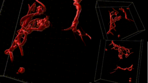 Blutgerinnsel in 3D. EMPA-Forscher wollen mit Machine Learning ein besseres Verständnis von Mikrogerinnseln entwickeln