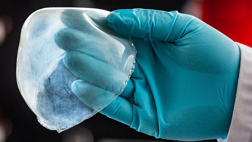 Der biomimetische
Gewebeersatz eröffnet neue Ansätze für
leistungsfähige Implantate – hier
demonstriert an einem gedruckten
Herzbeutel (Perikard).