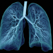 Digitaler Zwilling der Lunge mit Aerosolpartikeln