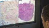 Auf den ersten Blick wie die Landkarte eines unbekannten Geländes: das Bild eines Gewebeschnitts in der Pathologie