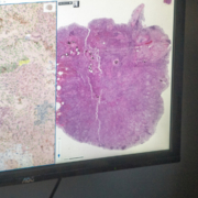Auf den ersten Blick wie die Landkarte eines unbekannten Geländes: das Bild eines Gewebeschnitts in der Pathologie