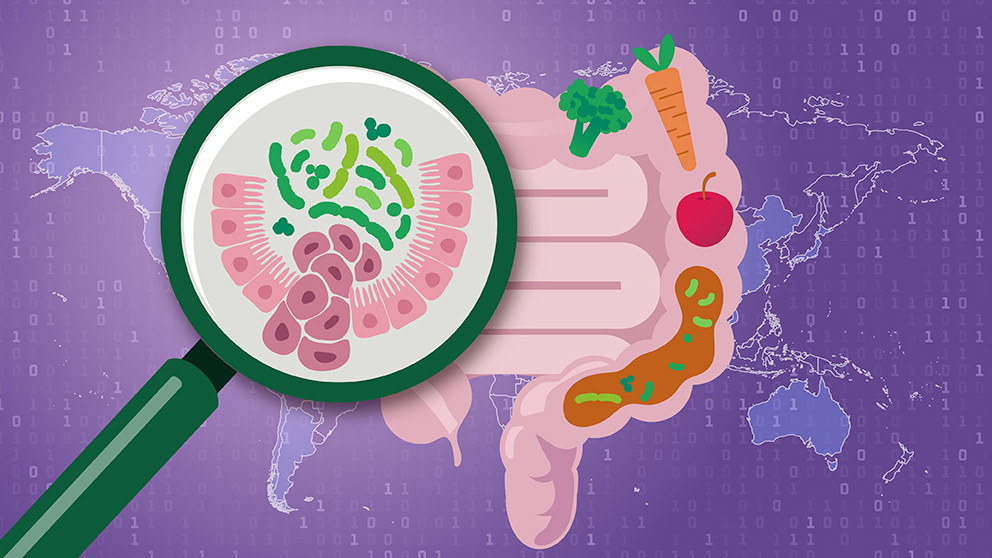 Neue, vom EMBL geleitete Forschung identifiziert eine robuste Darmmikrobiom-Signatur, die mit Darmkrebs assoziiert ist, populationsübergreifend, unabhängig von Sequenzierungsmethoden und Altersgruppen auftritt und mit einer niedrigen Ballaststoffzufuhr zusammenhängt.