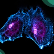Fluoreszenzmikroskopie von menschlichen Zellen mit RAD51C am Golgi-Aparat und am Zellkern in Magenta gefärbt, während das Zytoskelett der Zellle in Cyan leuchtet (F-Actin).
