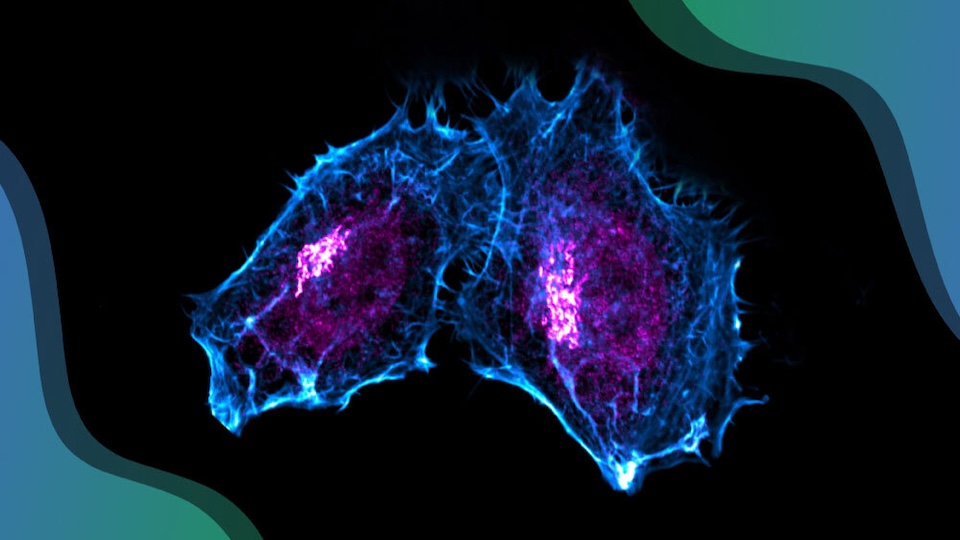PepperkokGroup-_GolgiDNADamageRepair Fluoreszenzmikroskopie von menschlichen Zellen mit RAD51C am Golgi-Aparat und am Zellkern in Magenta gefärbt, während das Zytoskelett der Zellle in Cyan leuchtet (F-Actin).