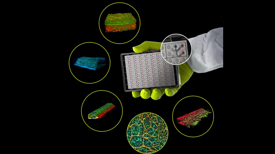 960 x 540 mimetas bruker26 Eine große Auswahl an Organoid-Modellsystemen wird für die Wirkstoffforschung immer interessanter. Die Anbieter von Forschungswerkzeugen kaufen die Technologieplattformen ein.