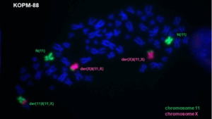 Fluoreszenz-Aufnahme der Chromosomen von Zelllinie KOPM-88. Die Chromosomen 11 und X sind spezifisch angefärbt
und lassen die Fusion beider Chromosomen als „Derivate“ der (11) und der (X) erkennen, wo sich das Fusionsgen
KMT2A::SEPTIN6 befindet.