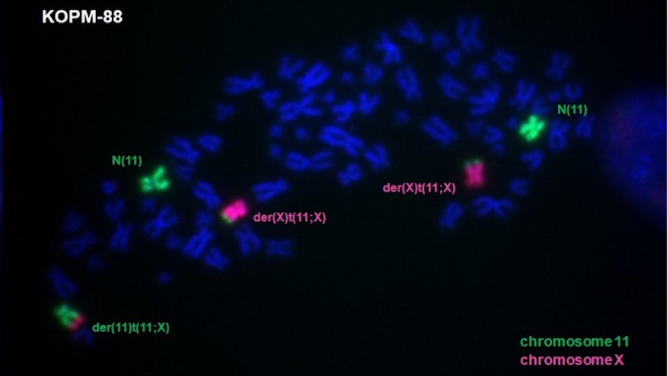 PM166_DSMZ_KOPM-88_Fluoreszenz Fluoreszenz-Aufnahme der Chromosomen von Zelllinie KOPM-88. Die Chromosomen 11 und X sind spezifisch angefärbt
und lassen die Fusion beider Chromosomen als „Derivate“ der (11) und der (X) erkennen, wo sich das Fusionsgen
KMT2A::SEPTIN6 befindet.