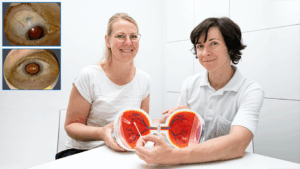 Dr. Ekaterina Sokolenko (rechts) und Anke Beckmann zeigen an einem Augenmodell, wo das PDS-Implantat im Auge sitzt. Die kleinen Fotos links oben verdeutlichen, dass das Implantat unter dem
Oberlid verschwindet, es ist normalerweise nicht sichtbar.