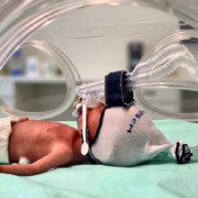 Das InhalPlus Bypass-System an einem Frühgeborenen-Modell im Inkubator